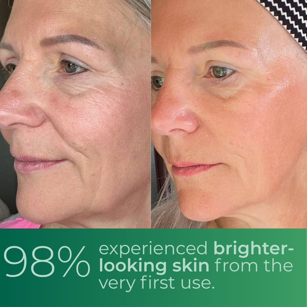 Subliskin Lustré™ – The #1 Shortcut to Flawless “Glass Skin”