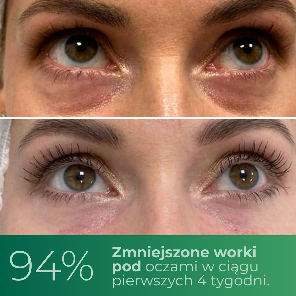 Noctivè Eye Balm – Redukuje opuchliznę, zmarszczki i cienie pod oczami