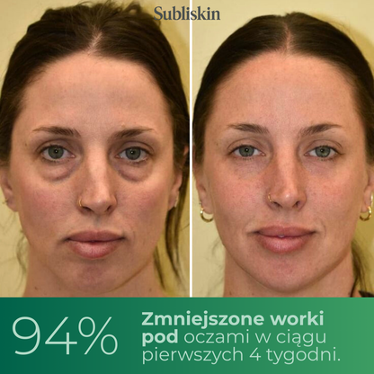 Noctivè Eye Balm – Redukuje opuchliznę, zmarszczki i cienie pod oczami