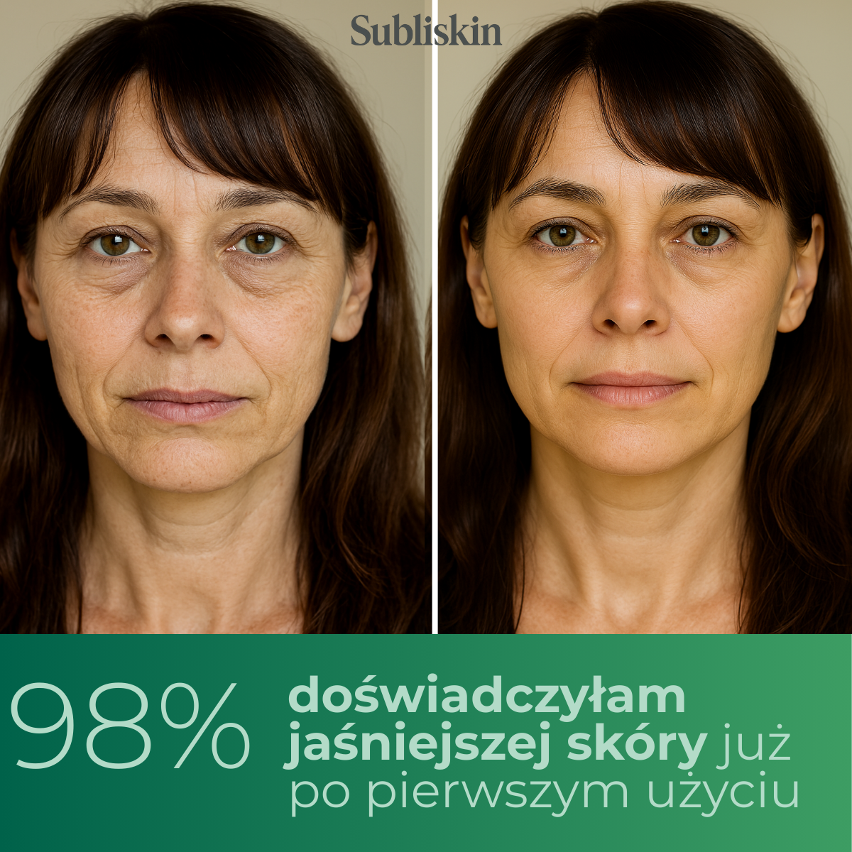 Noctivè Eye Balm – Redukuje opuchliznę, zmarszczki i cienie pod oczami